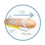 un dispositivo di potenziamento maschile leader che offre ingrandimento pene sicuro con comfort e discrezione.
