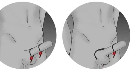 ElectraStim Metallic Adjustable Scrotal Loop. Unlock intense pleasure with the Metallic Adjustable Scrotal Loop.